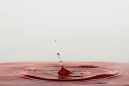 remove red wine stains